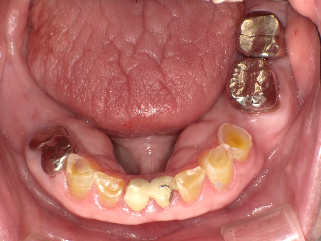 原因は何ですか?